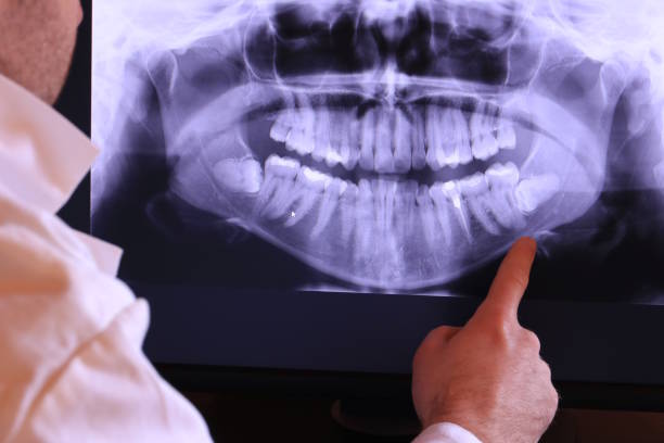 Best Mobile Emergency Dentist in La Mirada, CA